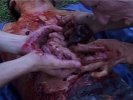 Fontane di Sangue